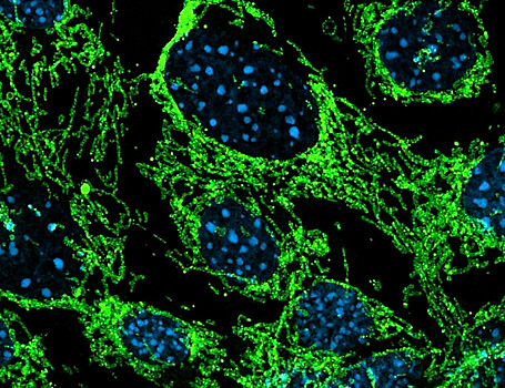 Эпигенетический регулятор MOF связывает ядро и митохондрию