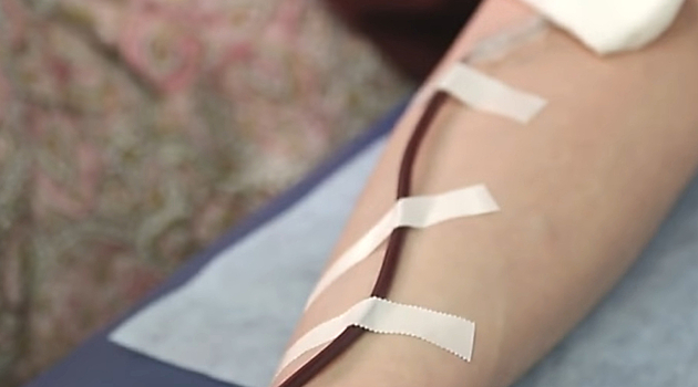 Депутат предложил принудительно выкачивать кровь из военнопленных на донорство