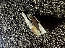 10-летний россиянин поднял на улице купюру и лишился пальцев. Что в ней было