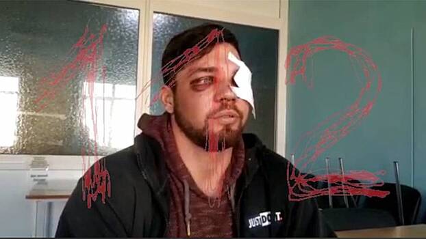 Избитый в метро Роман Ковалев рассказал о случившемся