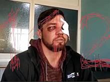 Избитый в метро Роман Ковалев рассказал о случившемся