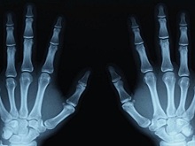 Опасен ли рентген?