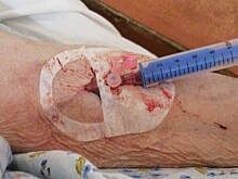 В рязанской ОКБ едва не умерла пенсионерка, главврач взял проблему на контроль