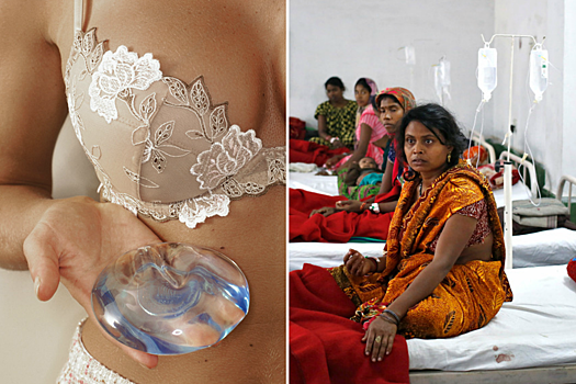 Бедным жителям Индии начнут бесплатно делать пластику груди