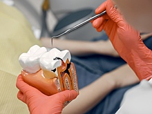 Найдена дешёвая альтернатива традиционному способу лечения кариеса