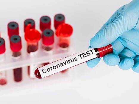 Молодая американка умерла в ожидании теста на коронавирус