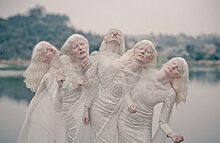 «Белоснежки»: альбиносы, которые стали моделями ( I часть)