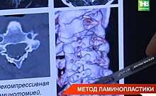 Молодой врач из РКБ первым в Татарстане провел ламинопластику — видео