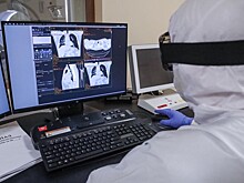 Иммунолог назвала отличия между обычной пневмонией и COVID-19