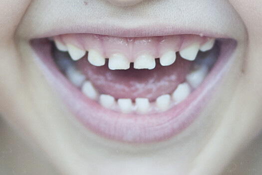 Пять советов, которые помогут облегчить боль при прорезывании зубов