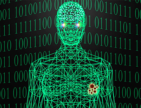 Искусственный интеллект прогнозирует риск рака груди