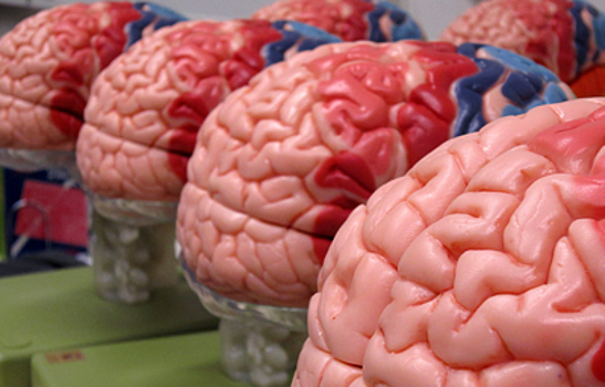 В Гарварде тестируют новый вид мозговых имплантатов