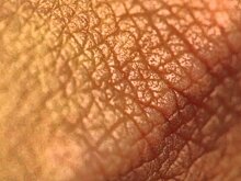 Учёные рассказали, что может провоцировать меланому