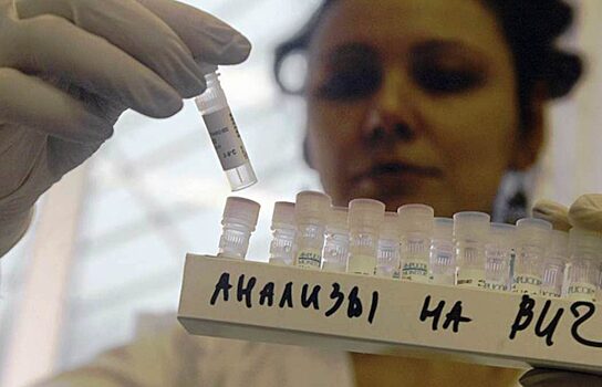 В Тюменской области стабилизируется ситуация с ВИЧ