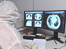 Побочное действие «Спутника V» — в рамках нормы