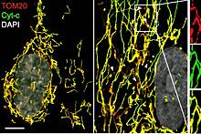 Раскрыт связанный с митохондриями механизм старения