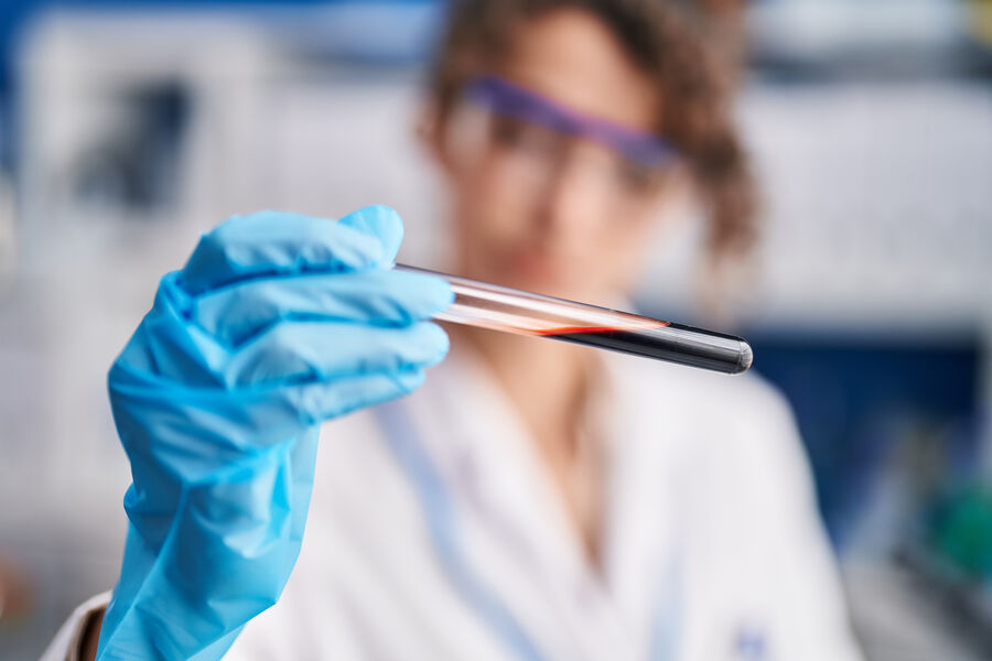 Прибывающих из Чехии россиян начали тестировать на гепатит