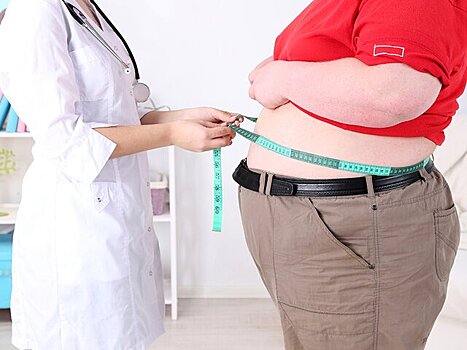 Пациентам с ожирением предложили обеспечить доступ к хирургическому лечению по ОМС