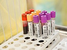 Власти Татарстана утвердили нормативные затраты на заготовку, хранение и транспортировку донорской крови