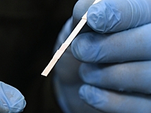 Россиянам назвали способы избежать ошибок при проверке антител к COVID-19