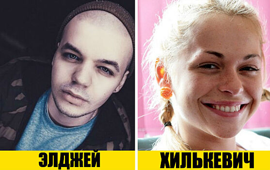 Как выглядели российские звезды до того, как прославились? 11 редких фото