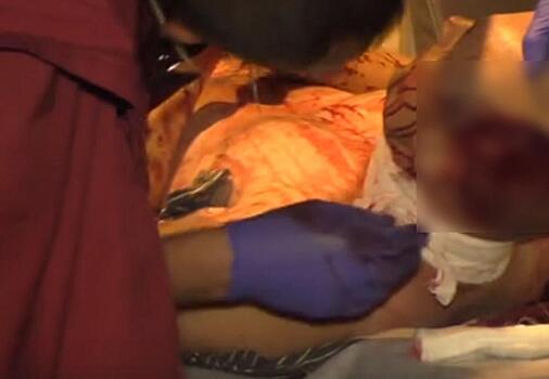 В Кирове пассажир напал с ножом на водителя такси: окровавленного мужчину увезла скорая