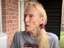 В США 70-летняя женщина попыталась загрызть питбуля