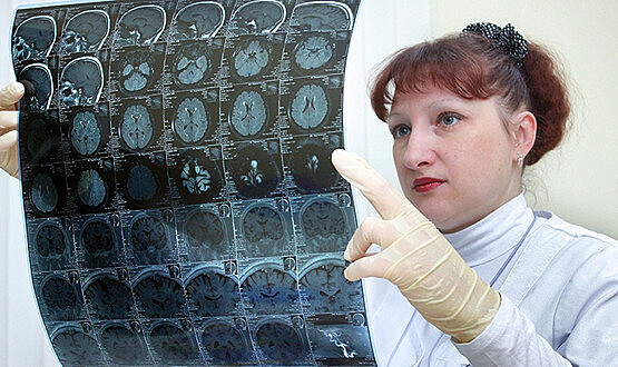 Россияне стали чаще болеть раком мозга