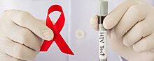 В странах Европы неуклонно растет количество заболевших ВИЧ-инфекцией
