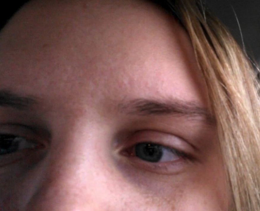 Морщины. Наружное строение глаза. Морщины на лице. Девушка с прикрытыми глазами. Здоровый глазанаривованный.