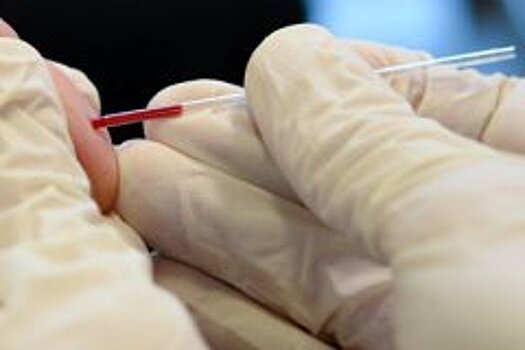 Умная бумага определяет группу крови человека за 30 секунд