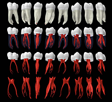 Вести с полей: микротомография в исследовании болезней зубов