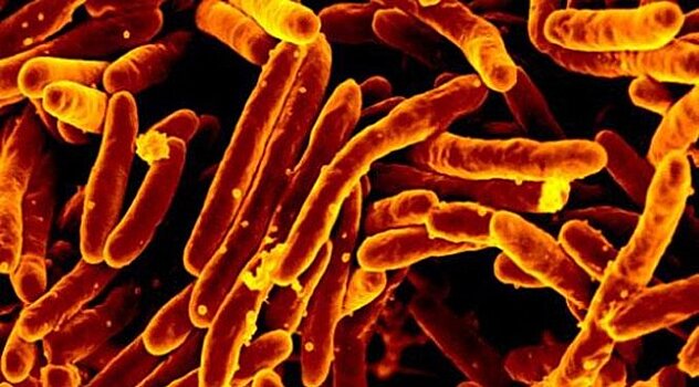 Найден способ поражать бактерии туберкулеза в латентной форме