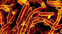 В Германии растет заболеваемость туберкулезом