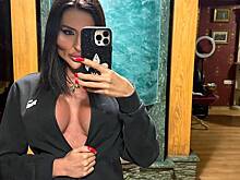 Украинка с самыми большими щеками в мире обнажила грудь на фото