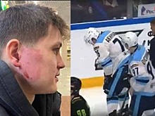 Шайба попала в ухо 23-летнему защитнику ХК «Сибирь» Тимуру Ахиярову