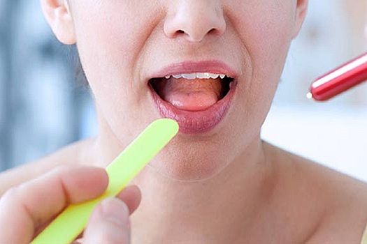 Онколог рассказал о неочевидных симптомах рака языка