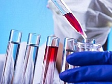 Минздрав назвал закономерным рост заболеваемости COVID-19 в сентябре
