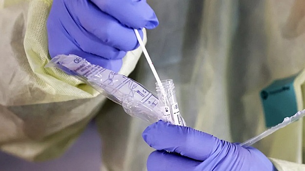 Новый ПЦР-тест на коронавирус создали российские ученые
