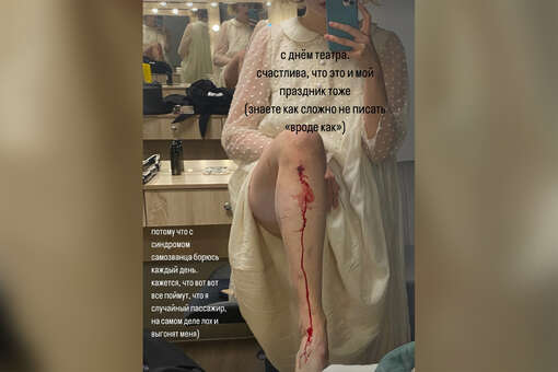Актриса Александра Бортич опубликовала фото с травмой ноги