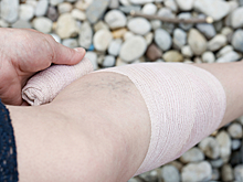 Первые признаки образования тромба