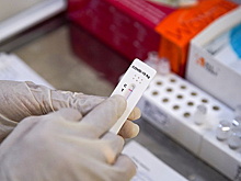 В России выросла доля положительных тестов на COVID-19 в частных лабораториях