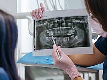 Стоматолог назвал самые частые сценарии «развода» пациентов на деньги