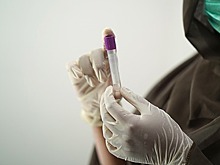 Российские эпидемиологи научились ускоренно определять источник ВИЧ