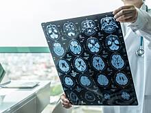 Врачи списали симптомы рака у 22-летней девушки на тепловой удар