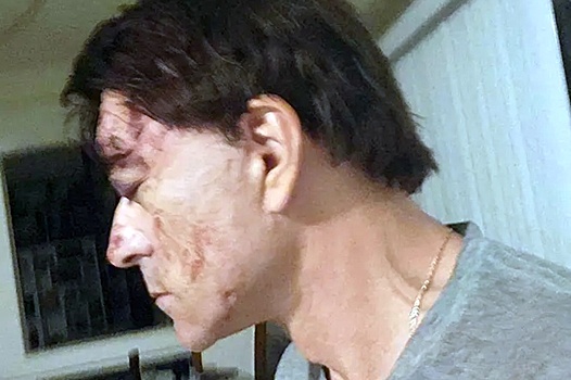 Пасынка Армена Джигарханяна ранили в голову в Лас-Вегасе