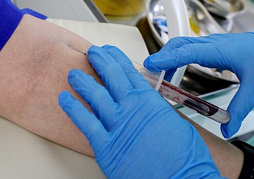 В России объяснили скачок заболеваемости сифилисом