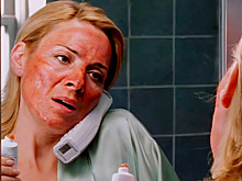 Названы три процедуры красоты, во время которых сдирают кожу