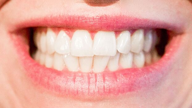 Стоматолог назвала полезные для зубов сладости