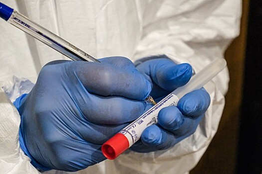 В РФ зарегистрировано более 120 тест-систем на выявление COVID-19 и антител